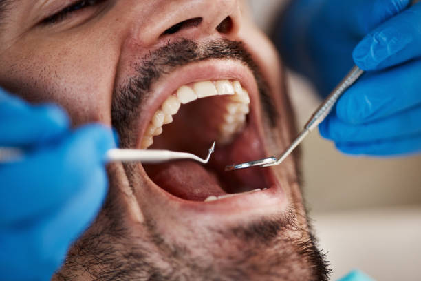 Best Cracked Tooth Emergency Dentist  in Jarrell, TX
